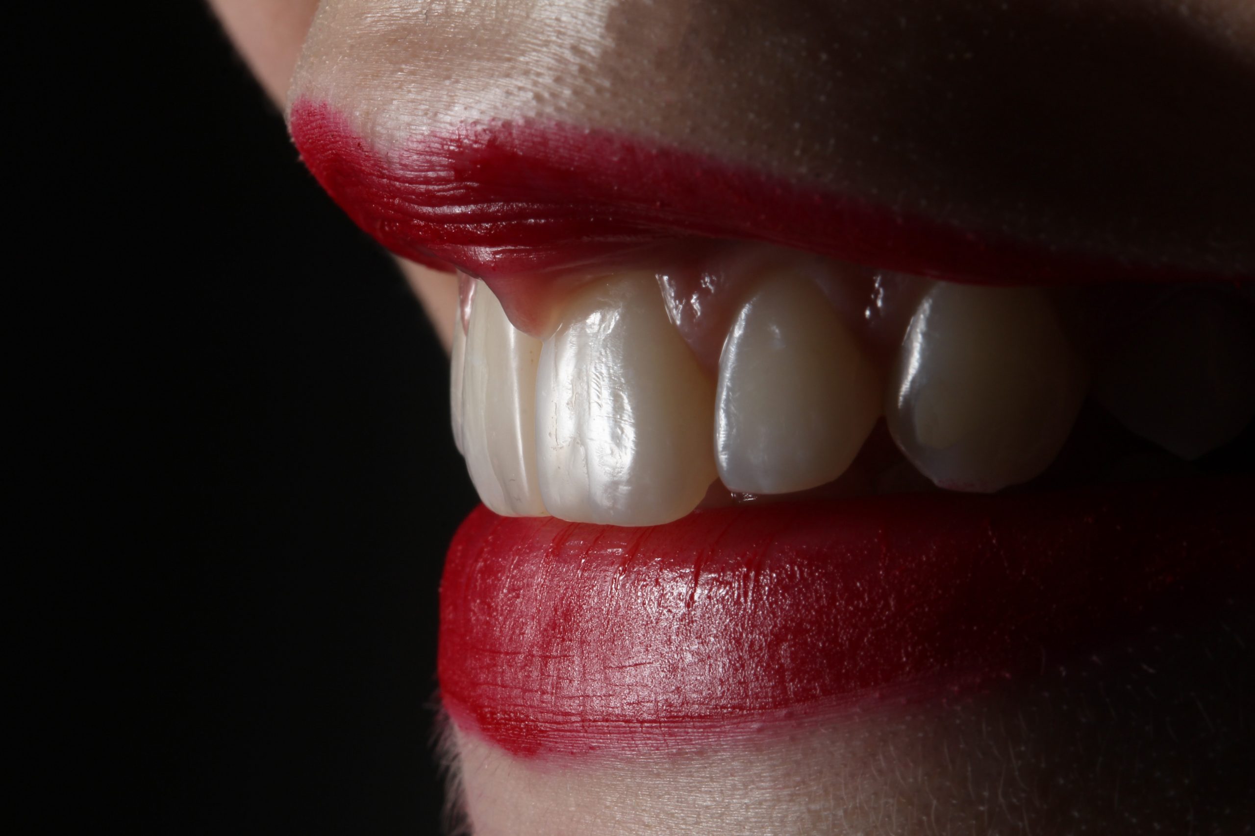 Estética dental en Sevilla para tu boca